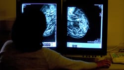 Preventing Breast Cancer With Late-Stage Drugs