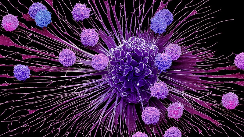 Tandem CAR T Shows Durable Remissions in Childhood Leukaemia