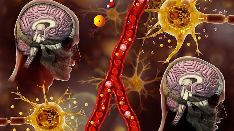 Correção rápida de sódio reduz mortalidade na hiponatremia