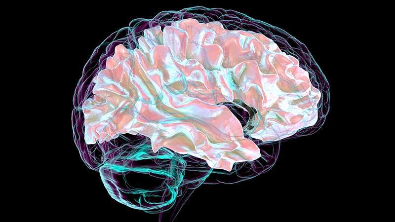 Fast Five Quiz: Multiple Sclerosis and Cognitive Impairment
