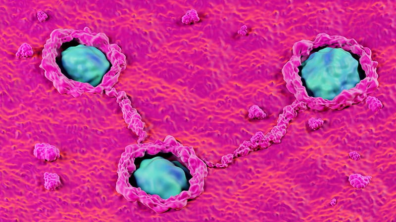 Fast Five Quiz: Tumor Microenvironment in CRC