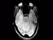 photo of  Brain scan