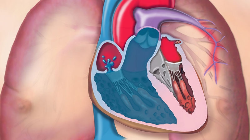Are We Missing Valvular Heart Disease in Cancer Patients?