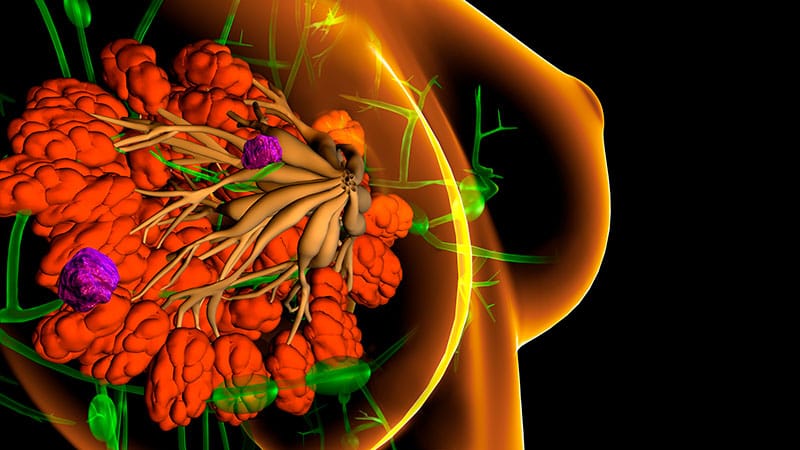 Fast Five Quiz: Escalation and De-Escalation of Therapy