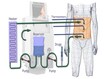 photo of hyperthermic intraperitoneal chemotherapy (HIPEC)