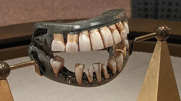 photo of Washington's teeth