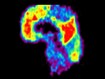 photo of Amyloid PET scans