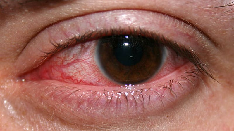 Revamped Antibiotic May Treat Deadly Eye Infection