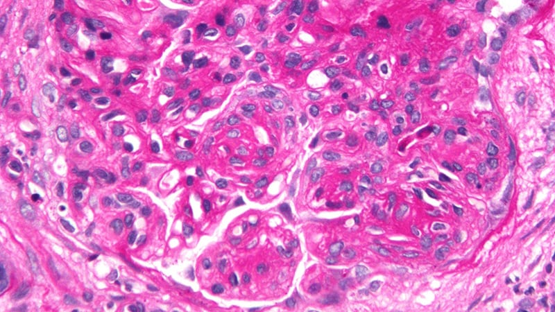 Novel Drug Shows Benefits in Rare C3G and Primary IC-MPGN