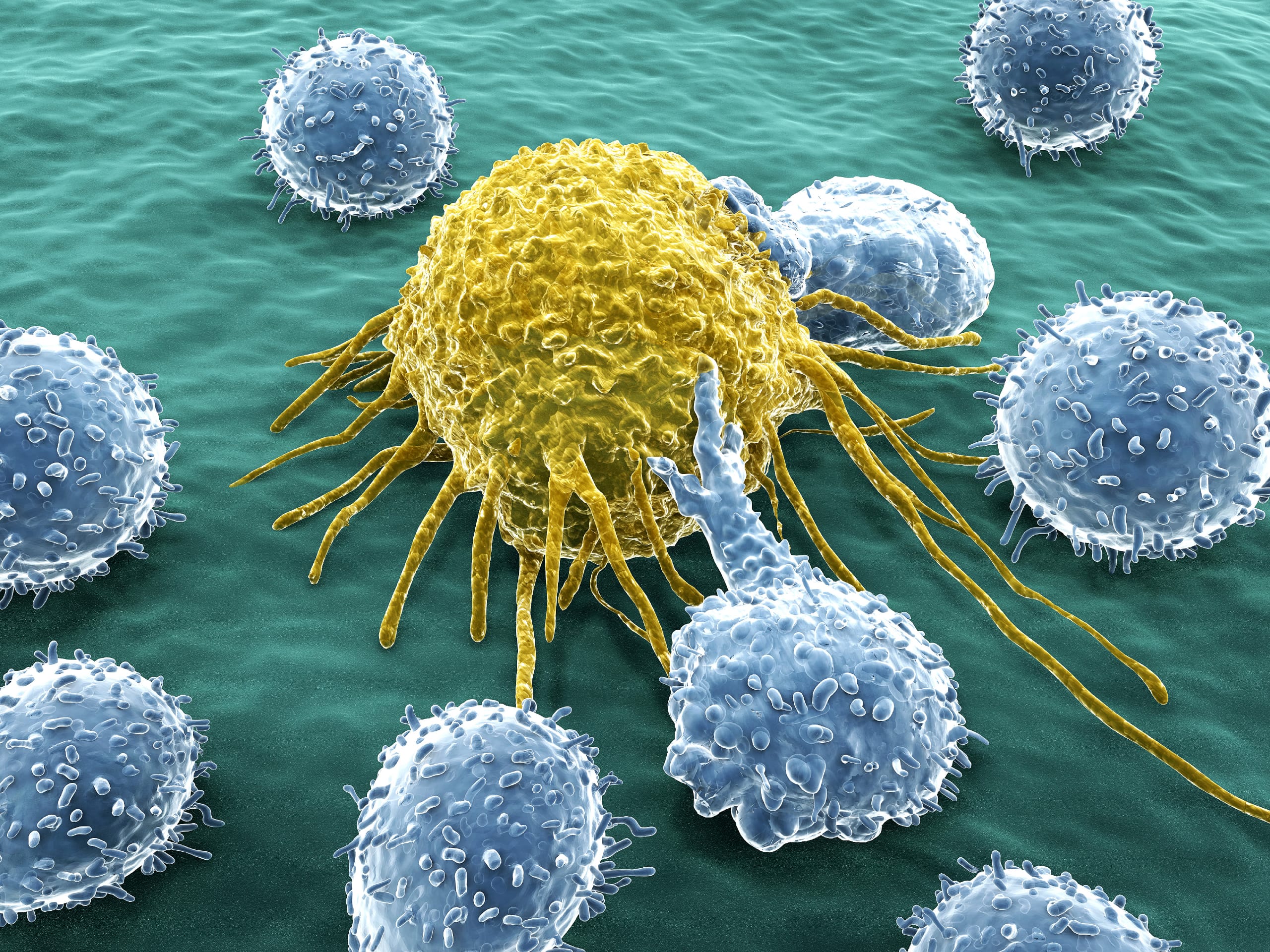 Immune System Can Be Triggered to Attack Cancer Cells