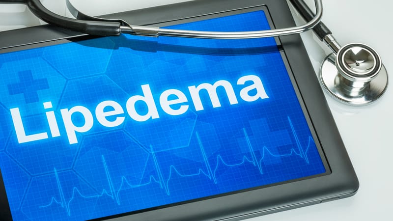 Lipedema Is Now Recognized as a Chronic Disease