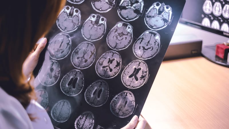 Atualização das diretrizes para avaliação do comprometimento cognitivo vascular