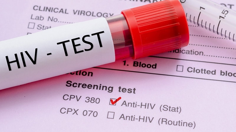 Estimating CVD Risk in People Living With HIV