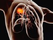 dt_210909_lung_cancer_tumors_800x450.jpg