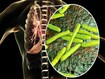 photo of tuberculosis in lungs 