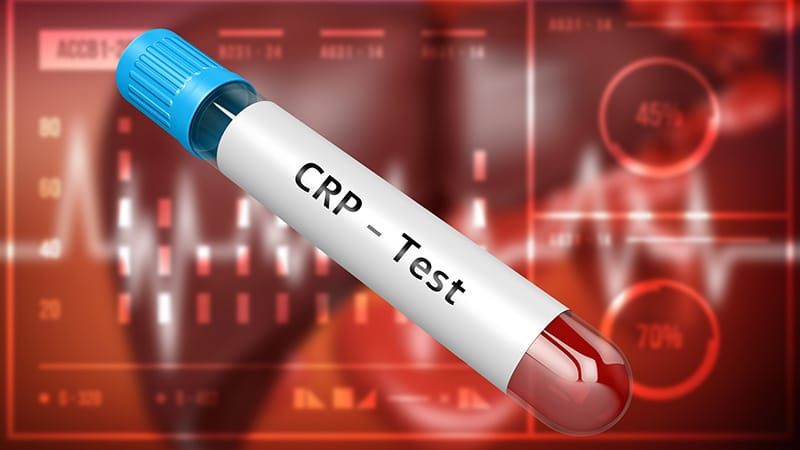 High-Sensitivity CRP a Useful Tool in Psoriatic Arthritis