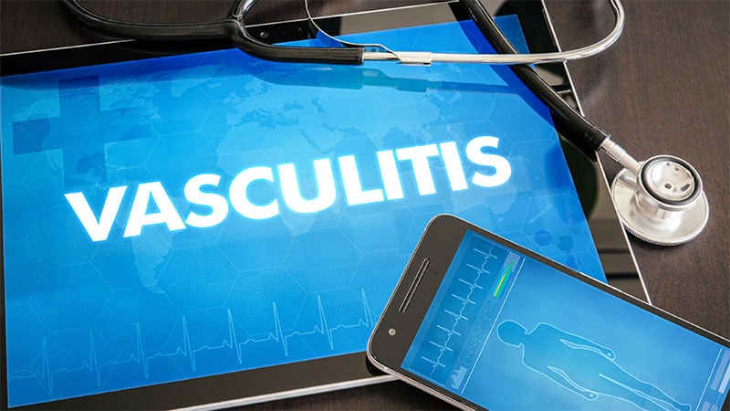 Managing ANCA Vasculitis: Guideline ‘Transcends’ Specialties