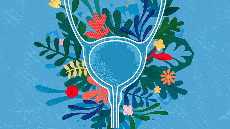 Empagliflozin Not Linked to Urinary Tract Cancer in T2D