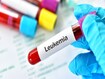 Blood sample tube for leukemia cells test