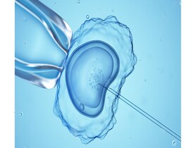 photo of In vitro fertilisation IVF
