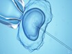 photo of In vitro fertilisation IVF