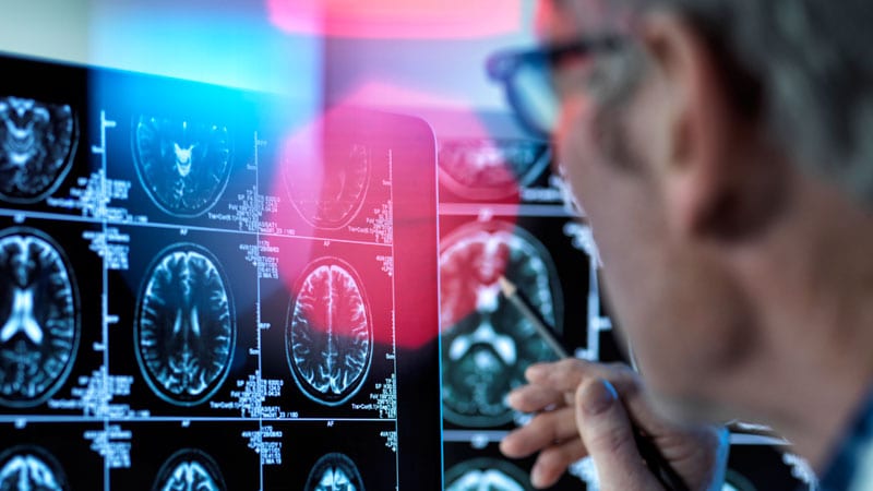 Radiology Workforce Shortages Impacting Cancer Care