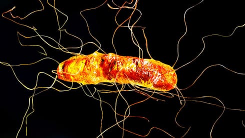Clostridium difficile Infection