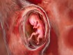 photo of Human fetus in the uterus