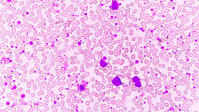 Ph-Positive Leukemia: No Longer a Death Sentence?