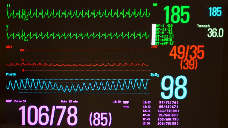 Adenosine Safe for Pediatric Tachyarrhythmia