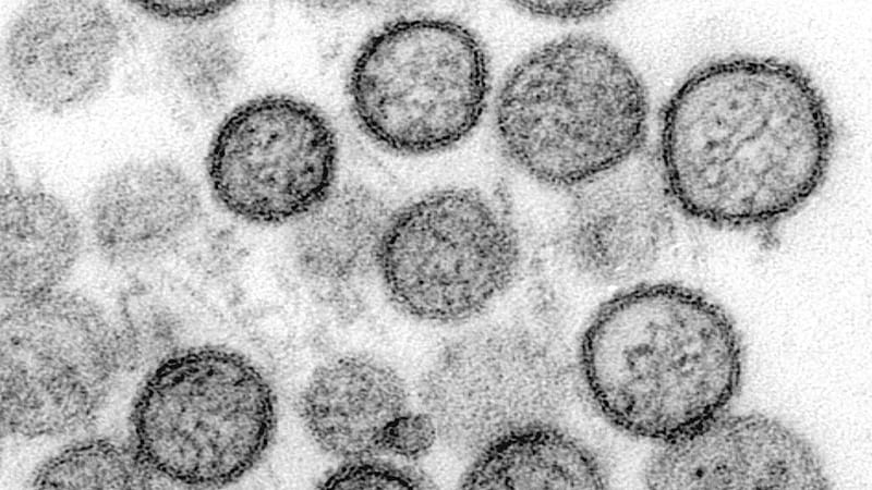 Cruise Ship Outbreak Raises Andes Virus Spread Concerns