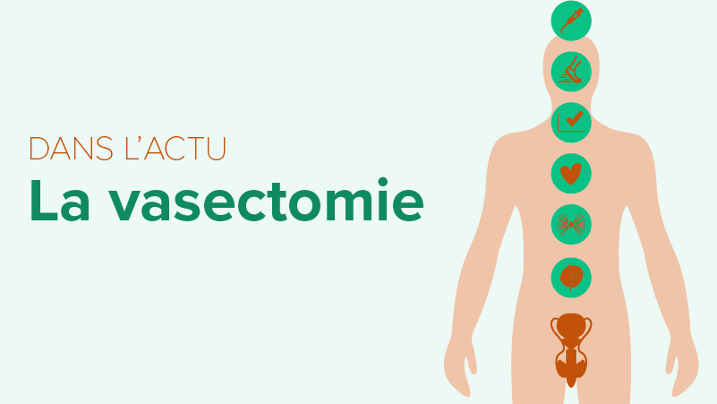 dans-l-actu-la-vasectomie