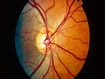 Fundus camera image of the human retina.