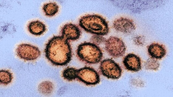 Image au microscope électronique en transmission de particules du coronavirus&nbsp;2 du syndrome respiratoire aigu sévère émergeant de la surface de cellules cultivées en laboratoire (NIAID-Rocky Mountain Laboratories&nbsp;; Creative Commons BY 2.0)