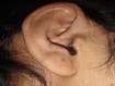 Picture of human female ear, anatomy