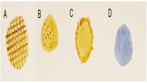 Figura 1. Métodos de cribado de Fibrilación auricular. Modificado y traducido de: Hindricks G, et al. 
<em>Eur Heart J</em>. 2021;42(5):373-498. "