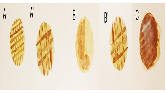Figura 3. Vía ABC de atención integrada para el tratamiento de la FA. Modificada y traducida de: Hindricks G, et al.
<em>Eur Heart J.</em> 2021;42(5):373-498.