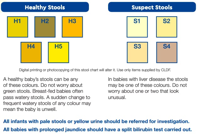 jaundice baby poop